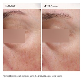 Face and Body Emulsion Niacinamide 5% - Leichte Emulsion